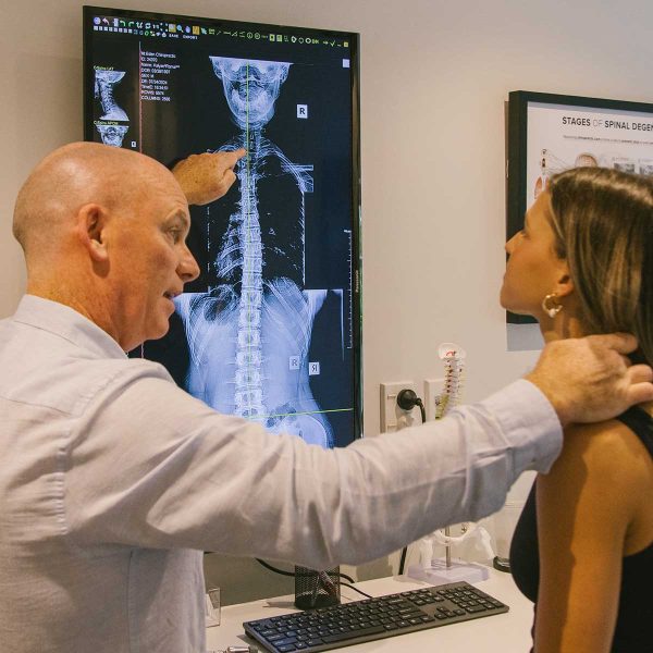 simon bourke auckland chiropractor showing xray to female patient